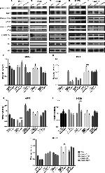 4EBP1 Antibody in Western Blot (WB)