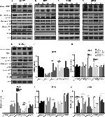 4EBP1 Antibody in Western Blot (WB)