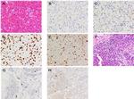 Creatine Kinase MB Antibody in Immunohistochemistry (IHC)