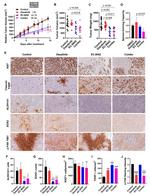 Phospho-FAK (Tyr861) Antibody in Immunohistochemistry (IHC)