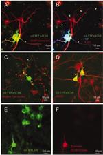 Tau Antibody in Immunocytochemistry (ICC/IF)