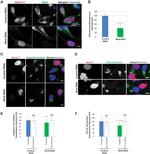 ITGB1 Antibody in Immunocytochemistry (ICC/IF)