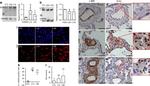 Alpha-Smooth Muscle Actin Antibody in Immunohistochemistry (IHC)