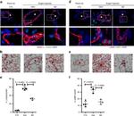 Alpha-Smooth Muscle Actin Antibody in Immunocytochemistry, Immunohistochemistry (ICC/IF, IHC)