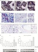 Alpha-Smooth Muscle Actin Antibody in Western Blot (WB)