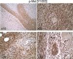 Phospho-c-Met (Tyr1003) Antibody in Immunohistochemistry (IHC)