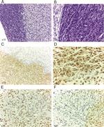 Phospho-c-Met (Tyr1003) Antibody in Immunohistochemistry (IHC)