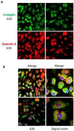 Galectin 3 Antibody in Immunocytochemistry (ICC/IF)