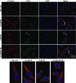 beta Tubulin Antibody in Immunocytochemistry (ICC/IF)