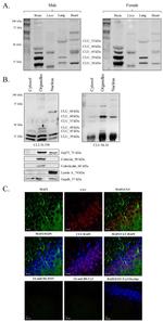 MAP2 Antibody in Immunohistochemistry (IHC)