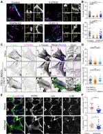 alpha Tubulin Antibody in Immunohistochemistry (IHC)