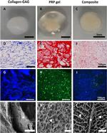 Fibrinogen gamma Antibody in Immunocytochemistry (ICC/IF)