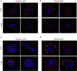 beta Catenin Antibody in Immunocytochemistry (ICC/IF)