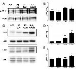 Phospho-ASK1 (Thr838) Antibody in Western Blot (WB)