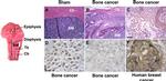 Estrogen Receptor alpha Antibody in Immunohistochemistry (IHC)