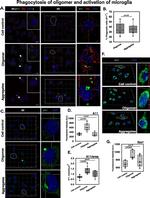 Tau Antibody in Immunocytochemistry (ICC/IF)