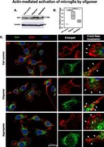 IBA1 Antibody in Immunocytochemistry (ICC/IF)