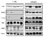 RAGE Antibody in Western Blot (WB)