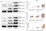 Osteocalcin Antibody in Western Blot (WB)