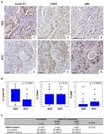 Cyclin D1 Antibody in Immunohistochemistry (IHC)