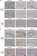 SR-BI Antibody in Immunohistochemistry (IHC)