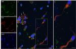 Cytokeratin Pan Antibody in Immunocytochemistry (ICC/IF)