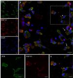 Cytokeratin Pan Antibody in Immunocytochemistry (ICC/IF)