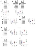 PDHA1 Antibody in Western Blot (WB)