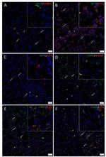 SOX2 Antibody in Immunohistochemistry (IHC)