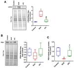 PDHA1 Antibody in Western Blot (WB)