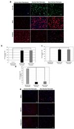 Calponin 1 Antibody in Immunocytochemistry (ICC/IF)