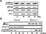 V-ATPase E1 Antibody in Western Blot (WB)