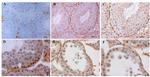 Claudin 1 Antibody in Immunohistochemistry (IHC)