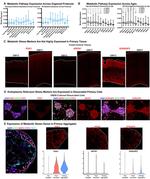 PGK1 Antibody in Immunohistochemistry (IHC)