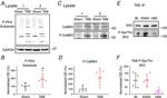 CaMKII alpha Antibody in Western Blot (WB)