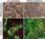 Cardiac Troponin T Antibody in Immunocytochemistry (ICC/IF)