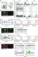 mCherry Antibody in Immunohistochemistry (IHC)