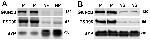 NMDAR2B Antibody in Western Blot (WB)