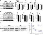 NMDAR2B Antibody in Western Blot (WB)