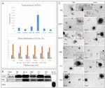 TSG101 Antibody in Western Blot (WB)