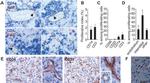 CD3 Antibody in Immunohistochemistry (IHC)