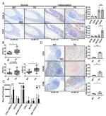 CD8a Antibody in Immunohistochemistry (IHC)