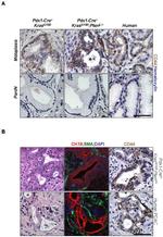 CD44 Antibody in Immunohistochemistry (IHC)