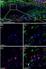 Ki-67 Antibody in Immunocytochemistry (ICC/IF)