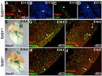 CD140b (PDGFRB) Antibody in Immunohistochemistry (IHC)