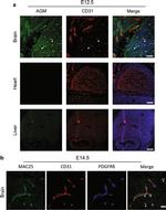 CD140b (PDGFRB) Antibody in Immunocytochemistry, Immunohistochemistry (ICC/IF, IHC)