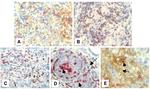 CD279 (PD-1) Antibody in Immunohistochemistry, Immunohistochemistry (Frozen) (IHC, IHC (F))