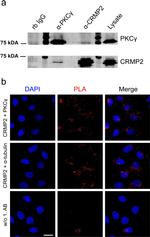 alpha Tubulin Antibody in Immunocytochemistry, Proximity Ligation Assay (PLA) (ICC/IF, PLA)