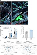 IL-6 Antibody in Immunohistochemistry (IHC)