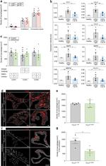 IL-6 Antibody in Immunohistochemistry (IHC)